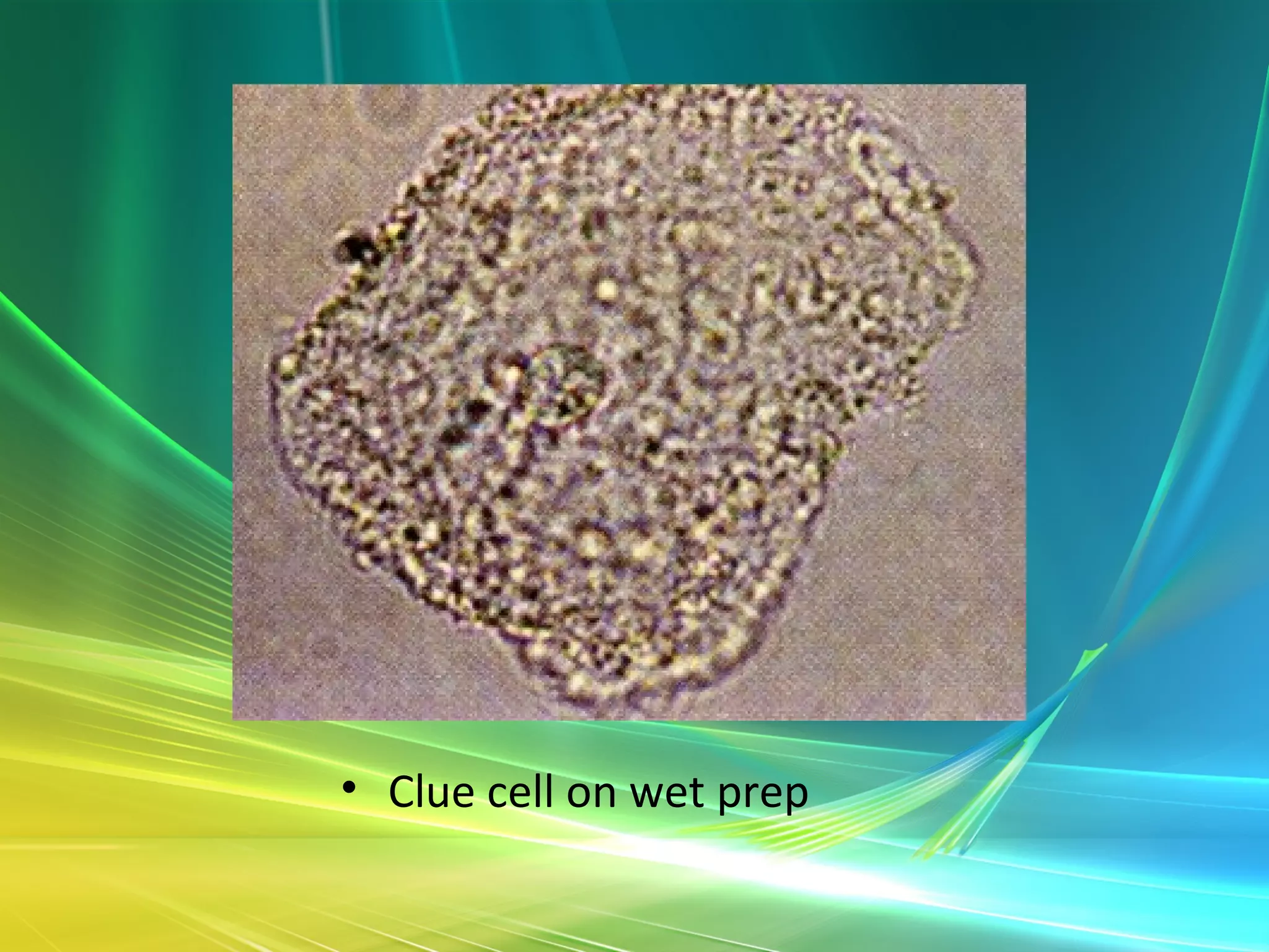 Vaginal discharge | PPT