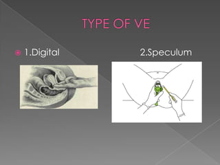    1.Digital   2.Speculum
 