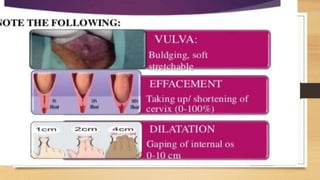 VAGINAL EXAMINATION PRESNTETION PPT.pptx