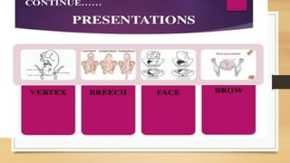 VAGINAL EXAMINATION PRESNTETION PPT.pptx
