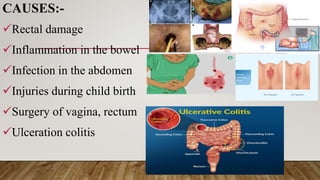 CAUSES:-
Rectal damage
Inflammation in the bowel
Infection in the abdomen
Injuries during child birth
Surgery of vagina, rectum
Ulceration colitis
 