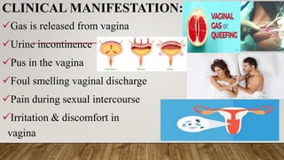 CLINICAL MANIFESTATION:-
Gas is released from vagina
Urine incontinence
Pus in the vagina
Foul smelling vaginal discharge
Pain during sexual intercourse
Irritation & discomfort in
vagina
 
