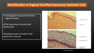 Identification of Vaginal Stratified Squamous Epithelial Cells
• Histological structure of human
vaginal tissues.
a)The squamous mucosa and
submucosa
b)Multiple layers of cells in the
squamous mucosa
(Source-Rechard Li)
 