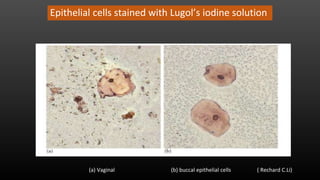 Epithelial cells stained with Lugol’s iodine solution
(a) Vaginal (b) buccal epithelial cells ( Rechard C.Li)
 