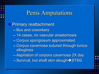 Penis Amputations Primary reattachment Bux and coworkers 14 cases, no vascular anastomosis Corpus spongiosum approximated Corpus cavernosa sutured through tunica albuginea Aspiration of corpora cavernosa 2X day Survival, but shaft skin slough  STSG 