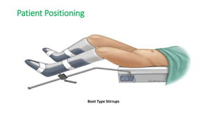 Patient Positioning
Boot Type Stirrups
 