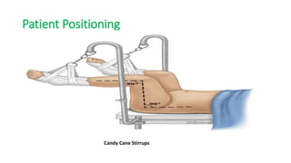 Patient Positioning
Candy Cane Stirrups
 