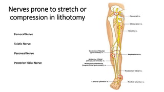 Nerves prone to stretch or
compression in lithotomy
Femoral Nerve
Sciatic Nerve
Peroneal Nerve
Posterior Tibial Nerve
 