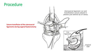 Procedure
Suture transfixion of the uterosacral
ligaments during vaginal hysterectomy
 