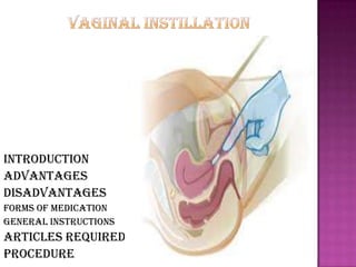 Introduction
Advantages
Disadvantages
Forms of medication
General instructions
Articles required
Procedure
 