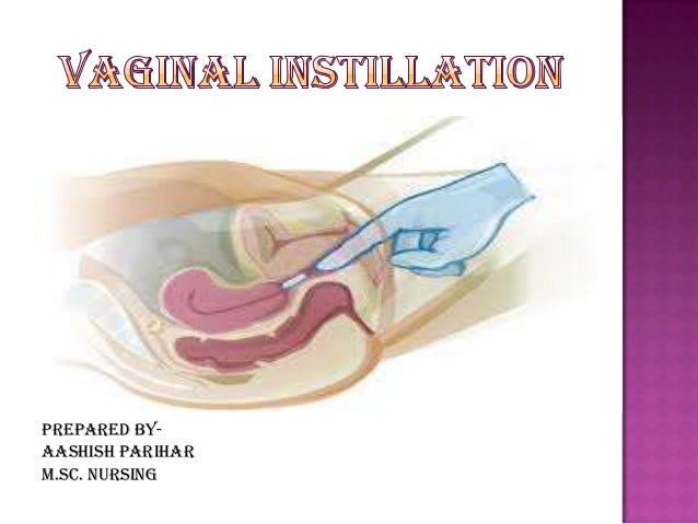 Vaginal Instillation Prepared By Aashish Parihar M Sc Nursing Vaginal Instillation Prepared By Aashish Parihar M Sc Nursing