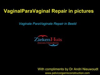 VaginalParaVaginal Repair in pictures With compliments by Dr Andri Nieuwoudt www.pelvicorganreconstruction.com Vaginale ParaVaginale Repair in Beeld 