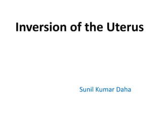 Inversion of the Uterus
Sunil Kumar Daha
 