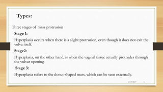 Types:
Three stages of mass protrusion
Stage 1:
Hyperplasia occurs when there is a slight protrusion, even though it does not exit the
vulva itself.
Stage2:
Hyperplasia, on the other hand, is when the vaginal tissue actually protrudes through
the vulvar opening.
Stage 3:
Hyperplasia refers to the donut-shaped mass, which can be seen externally.
01/07/2017 8
 