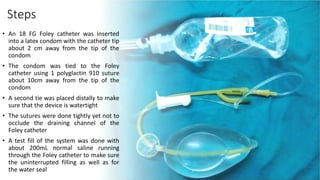 Steps
• An 18 FG Foley catheter was inserted
into a latex condom with the catheter tip
about 2 cm away from the tip of the
condom
• The condom was tied to the Foley
catheter using 1 polyglactin 910 suture
about 10cm away from the tip of the
condom
• A second tie was placed distally to make
sure that the device is watertight
• The sutures were done tightly yet not to
occlude the draining channel of the
Foley catheter
• A test fill of the system was done with
about 200mL normal saline running
through the Foley catheter to make sure
the uninterrupted filling as well as for
the water seal
 