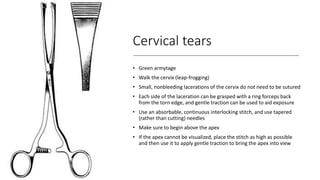 Cervical tears
• Green armytage
• Walk the cervix (leap-frogging)
• Small, nonbleeding lacerations of the cervix do not need to be sutured
• Each side of the laceration can be grasped with a ring forceps back
from the torn edge, and gentle traction can be used to aid exposure
• Use an absorbable, continuous interlocking stitch, and use tapered
(rather than cutting) needles
• Make sure to begin above the apex
• If the apex cannot be visualized, place the stitch as high as possible
and then use it to apply gentle traction to bring the apex into view
 