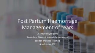 Post Partum Haemorrage
Management of tears
Dr. Indunil Piyadigama
Consultant Obstetrician and Gynaecologist
London Trainees Teaching
14th October 2021
 