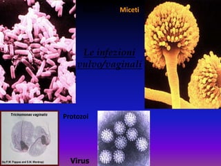 Batteri     MicetiLe infezioni vulvo/vaginaliProtozoiVirus