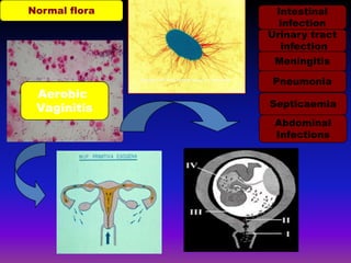 Enterococcus faecalisDonders 2002 International Juornal of Obstetrics and Gynecology