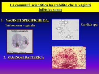 La comunità scientifica ha stabilito che le vaginiti infettive sono:VAGINITI SPECIFICHE DA:Candida spp.Trichomonas vaginalis	2.  VAGINOSI BATTERICA