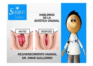HABLEMOS
DE LA
ESTÉTICA VAGINAL

REJUVENECIMIENTO VAGINAL
DR. OMAR GUILLERMO
www.senologiaGG.com

 