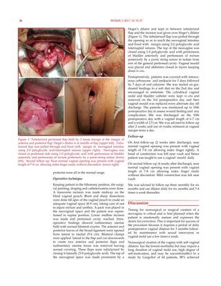 prolactin were all in the normal range.
Operative technique
Keeping patient in the lithotomy position, the surgi-
cal painting, draping and catheterization were done.
A transverse incision was made midway on the
blind vaginal pouch. Blunt and sharp dissections
were done till apex of the vaginal pouch to create an
adequate vaginal space (8-9 cm), taking care of not
to injure rectum and urethra. A pack was placed in
the neovaginal space and the patient was reposi-
tioned in supine position. Lower midline incision
was made and peritoneal cavity reached. Intra-
operative findings showed rudimentary uterine
bulb with normal bilateral ovaries. The anterior and
posterior leaves of the broad ligament were opened
from lateral to medial (5-6 cm). Bilateral clamps
were applied lateral to the flap and cut downwards
to create two anterior and posterior flaps and
rudimentary uterine tissue was removed leaving
serosal covering. These flaps were tubularized by
closing it laterally (3-0 polyglycolic acid). The top of
the neovaginal space was made prominent by a
Heger’s dilator and kept in between tubularized
flap and the incision was given over Heger’s dilator
(Figure 1). The tubularized flap was pulled through
the opening so as to reach the neovaginal introitus
and fixed with margin using 2-0 polyglycolic acid
interrupted sutures. The top of the neovagina was
closed using 1-0 polyglycolic acid with peritoneum
of bladder anteriorly and peritoneum of rectum
posteriorly by a purse string suture to isolate from
rest of the general peritoneal cavity. Vaginal mould
was placed and abdomen closed in layers keeping
drain in situ.
Postoperatively, patients was covered with intrave-
nous ceftriaxone and amikacin for 3 days followed
by 7 days of oral cefexime. She was started on gra-
duated feedings to a soft diet on the 2nd day and
encouraged to ambulate. The cylindrical vaginal
mold and bladder catheter were kept in situ and
removed on the 3rd postoperative day and then
vaginal mould was replaced every alternate day till
discharge. The patients was monitored up to 10th
postoperative day to assess wound healing and any
complication. She was discharged on the 10th
postoperative day with a vaginal length of 6-7 cm
and a width of 2.5 cm. She was advised to follow-up
after 2 weeks and use of viodin ointment at vaginal
margin twice a day.
Follow-up
On first follow-up (2 weeks after discharge), near
normal vaginal opening was present with vaginal
length of 7-8 cm allowing index finger tightly. A
band of constriction was felt near vault and hence
patient was taught to use a vaginal mould daily.
On second follow-up (4 weeks after discharge), near
normal vaginal opening was present with vaginal
length of 7-8 cm allowing index finger easily
without discomfort. Mild constriction was felt near
vault.
She was advised to follow-up three monthly for six
months and use dilator daily for six months and 3-4
times a week thereafter.
Discussion
Timing for nonsurgical or surgical creation of a
neovagina is critical and is best planned when the
patient is emotionally mature and expresses the
desire for correction. This is important for success of
the procedure because it requires a period of daily
postoperative vaginal dilation for 3 months follow-
ed by maintenance with sexual intercourse or
vaginal mold use a few times a week.
Nonsurgical creation of the vagina with self-vaginal
dilators has the lowest morbidity but may require a
long duration of vaginal mold use, high degree of
self-motivation, and may be uncomfortable.4 In a
study by Gargollo3 of 64 patients, 88% achieved
36 BSMMU J 2017; 10: 35-37
Figure 1: Tubularized peritoneal flap held by 2 tissue forceps at the margin of
anterior and posterior flap. Hegar’s dilator is at middle of flap (upper left); Tubu-
larized flap was pulled through and fixed with margin of neovaginal introitus
using 2-0 polyglycolic acid-interrupted sutures (upper right); Neovagina was
closed at peritoneal side using 1-0 polyglycolic acid with peritoneum of bladder
antariorly and peritoneum of rectum posteriorly by a purse-string suture (lower
left); Second follow-up; Near normal vaginal opening was present with vaginal
length of 7-8 cm allowing index finger easily without discomfort (lower right)
 