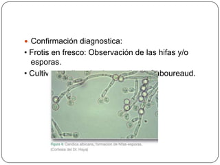  Confirmación diagnostica:
• Frotis en fresco: Observación de las hifas y/o
  esporas.
• Cultivo: medio selectivo medio de Saboureaud.
 