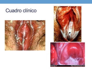 Cuadro clínico
 