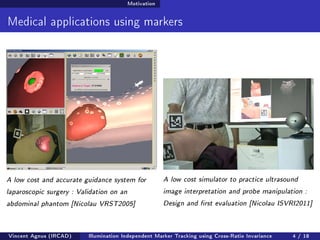 Motivation 
Medical applications using markers 
A low cost and accurate guidance system for 
laparoscopic surgery : Validation on an 
abdominal phantom [Nicolau VRST2005] 
A low cost simulator to practice ultrasound 
image interpretation and probe manipulation : 
Design and rst evaluation [Nicolau ISVRI2011] 
Vincent Agnus (IRCAD) Illumination Independent Marker Tracking using Cross-Ratio Invariance 4 / 18 
 