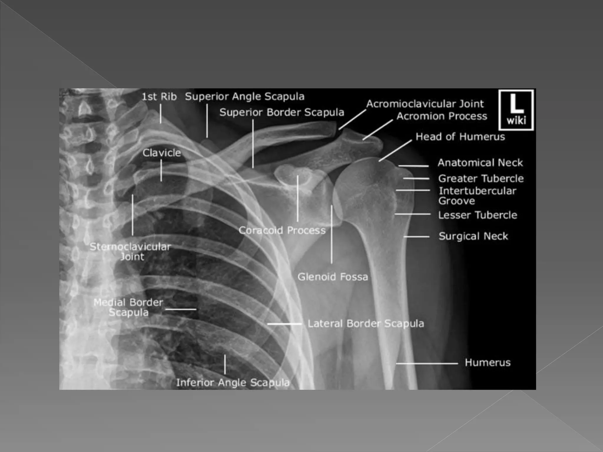 Shoulder X ray PPT shoulder-x-ray-ppt