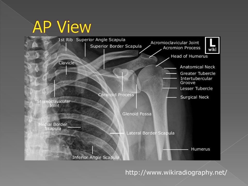Shoulder xray