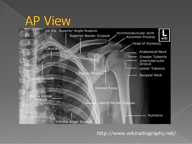 Shoulder x-ray