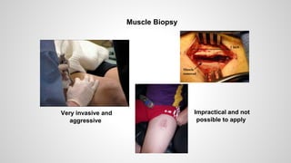 Muscle Biopsy
Very invasive and
aggressive
Impractical and not
possible to apply
 