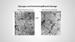 Before Intense/long Exercise After Intense/Long Exercise
Glycogen and Overtraining/Muscle Damage
 