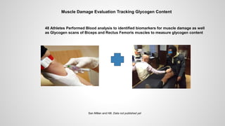 Muscle Damage Evaluation Tracking Glycogen Content
48 Athletes Performed Blood analysis to identified biomarkers for muscle damage as well
as Glycogen scans of Biceps and Rectus Femoris muscles to measure glycogen content
San Millan and Hill. Data not published yet
 