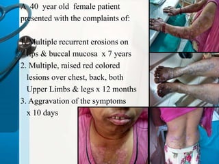 A 40 year old female patient 
presented with the complaints of: 
1. Multiple recurrent erosions on 
lips & buccal mucosa x 7 years 
2. Multiple, raised red colored 
lesions over chest, back, both 
Upper Limbs & legs x 12 months 
3. Aggravation of the symptoms 
x 10 days 
 