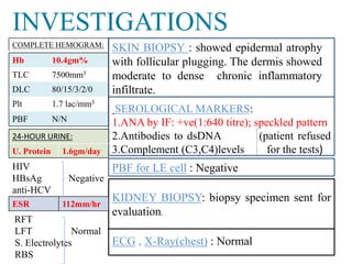 INVESTIGATIONS 
KIDNEY BIOPSY: biopsy specimen sent for 
evaluation. 
ECG , X-Ray(chest) : Normal 
COMPLETE HEMOGRAM: 
Hb 10.4gm% 
TLC 7500mm3 
DLC 80/15/3/2/0 
Plt 1.7 lac/mm3 
PBF N/N 
24-HOUR URINE: 
U. Protein 1.6gm/day 
HIV 
HBsAg Negative 
anti-HCV 
ESR 112mm/hr 
SKIN BIOPSY : showed epidermal atrophy 
with follicular plugging. The dermis showed 
moderate to dense chronic inflammatory 
infiltrate. 
SEROLOGICALMARKERS: 
1.ANA by IF: +ve(1:640 titre); speckled pattern 
2.Antibodies to dsDNA (patient refused 
3.Complement (C3,C4)levels for the tests) 
PBF for LE cell : Negative 
RFT 
LFT Normal 
S. Electrolytes 
RBS 
 
