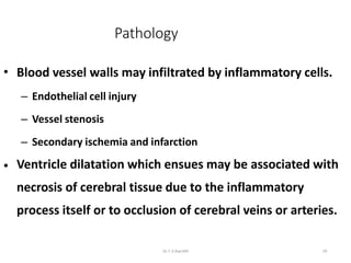 meningitis | PPTX