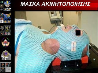 ΜΑΣΚΑ ΑΚΙΝΗΤΟΠΟΙΗΣΗΣ 