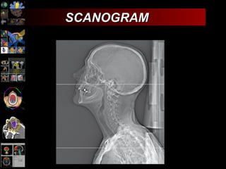 SCANOGRAM 