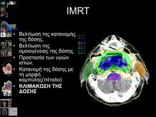 IMRT B ελτίωση της κατανομής της δόσης. Βελτίωση της ομοιογένειας της δόσης. Προστασία των υγιών ιστών.  Κατανομή της δόσης με τη μορφή καμπύλης(πέταλο) ΚΛΙΜΑΚΩΣΗ ΤΗΣ ΔΟΣΗΣ 