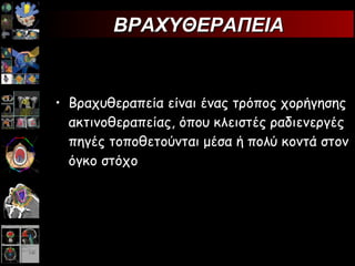Βραχυθεραπεία είναι ένας τρόπος χορήγησης ακτινοθεραπείας, όπου κλειστές ραδιενεργές πηγές τοποθετούνται μέσα ή πολύ κοντά στον όγκο στόχο ΒΡΑΧΥΘΕΡΑΠΕΙΑ 
