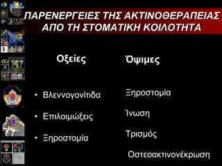 Οξείες Βλεννογονίτιδα Επιλοιμώξεις Ξηροστομία ΠΑΡΕΝΕΡΓΕΙΕΣ ΤΗΣ ΑΚΤΙΝΟΘΕΡΑΠΕΙΑΣ ΑΠΟ ΤΗ ΣΤΟΜΑΤΙΚΗ ΚΟΙΛΟΤΗΤΑ Όψιμες Ξηροστομία Ίνωση Τρισμός Οστεοακτινονέκρωση 
