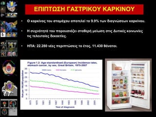 Καινγεξίδε Μ-Α, MD, PhD. Επηκειήηξηα Β’ Αθηηλνζεξαπεπηηθήο Ογθνινγίαο. Παλεπηζηεκηαθό ΓΝ Λάξηζαο
ΕΠΙΠΣΩ΢Η ΓΑ΢ΣΡΙΚΟΤ ΚΑΡΚΙΝΟΤ
• Ο θαξθίλνο ηνπ ζηνκάρνπ απνηειεί ην 9.9% ηωλ δηαγλώζεωλ θαξθίλνπ.
• Η ζπρλόηεηά ηνπ παξνπζηάδεη ζηαζεξή κείωζε ζηηο Δπηηθέο θνηλωλίεο
ηηο ηειεπηαίεο δεθαεηίεο.
• ΗΠΑ: 22.280 λέεο πεξηπηώζεηο ην έηνο, 11.430 ζάλαηνη.
 