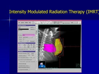 The pliable breast tissue is wrapped around the applicator. Subcutaneous stitches aid conformation, while ensuring that the skin is at least 1cm from the applicator surface.