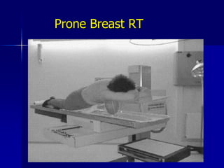 Patient’s PositionProne and IMRTLateral DecubitusCampana et al 2005DeWyngaert et al 2007