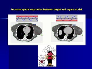 Varian RPM respiratory management system