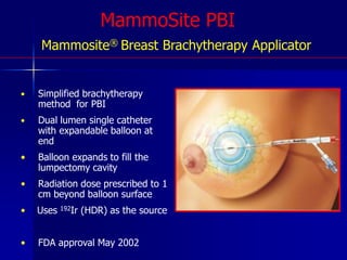 MultiCatheter PBI:HDR/ LDR61 mo.5%89%61 y1.4 cm17.5%Average: