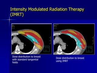 Dose rate of about 2 Gy/min at 1 cm in waterSpherical applicators1.5 to 5cm diameter in 0.5cm stepsUniform surface dose-rate