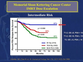 Memorial Sloan Kettering Cancer Center
          IMRT Dose Escalation
                      Intermediate Risk




                                                                     T1-2, GS 6, PSA > 10
                                                                     T1-2, GS >6, PSA  10
                                                                      T3, GS  6, PSA  10




Zelefsky MJ, Chan H, et. Al. Journal of Urology Vol. 176, 1415-1419, Oct 2006
 